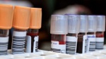 Comprehensive FIS Anti-Doping testing programme 2014/15
